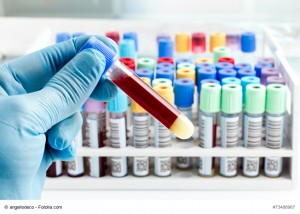 Vitamin B12 blood test