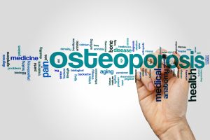 osteoporosis, bone health, health